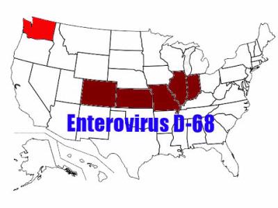 Enterovirus D-68 Confirmed in Two Patients at Childrens 